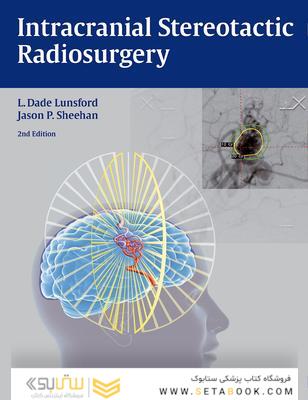 Intracranial Stereotactic Radiosurgery 2015