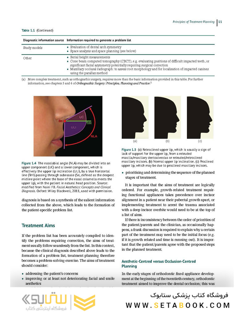 Preadjusted Edgewise Fixed Orthodontic Appliances: Principles and Practice 1st Edicion