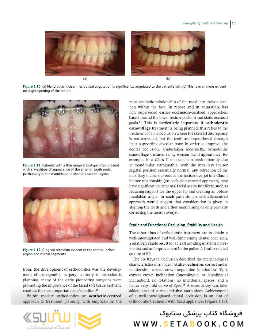 Preadjusted Edgewise Fixed Orthodontic Appliances: Principles and Practice 1st Edicion