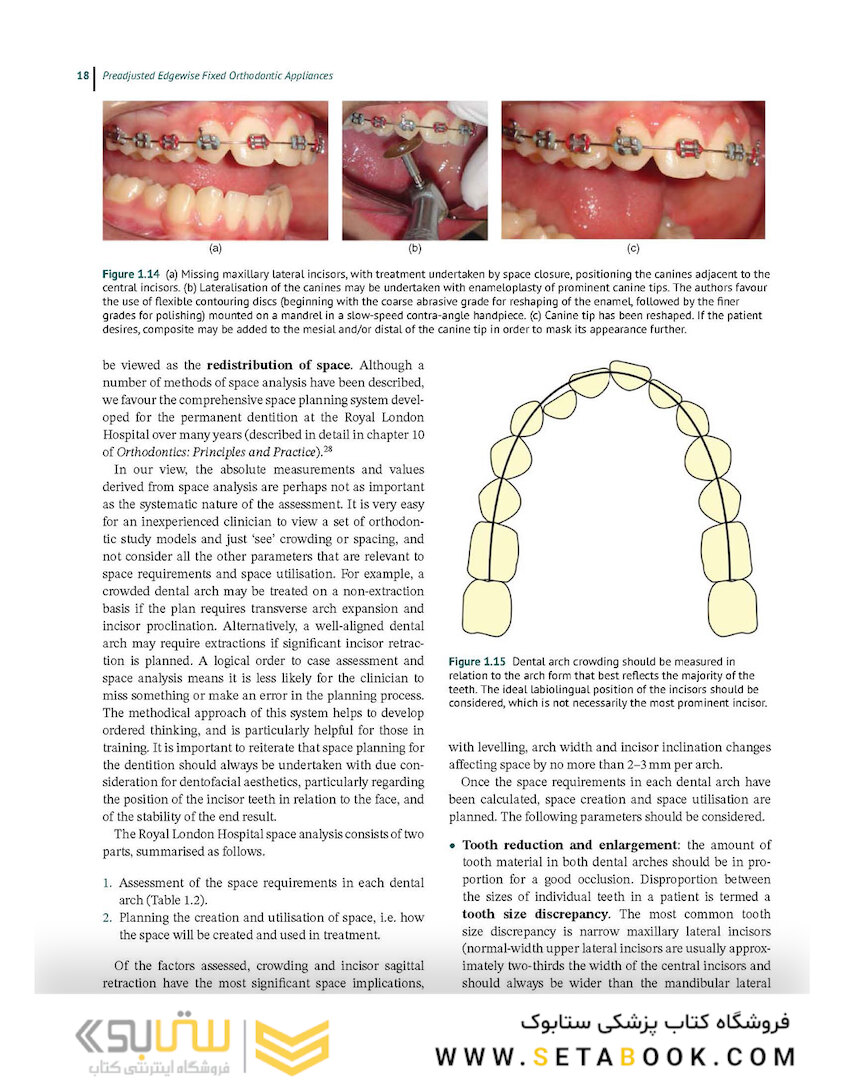 Preadjusted Edgewise Fixed Orthodontic Appliances: Principles and Practice 1st Edicion