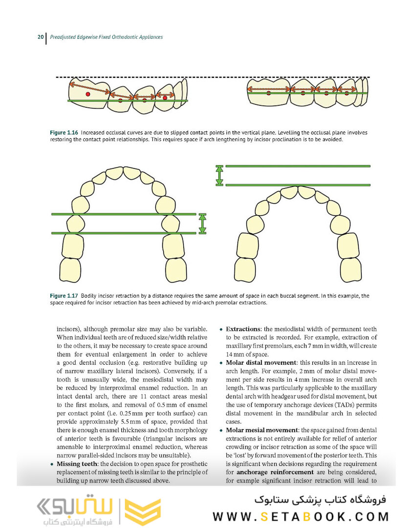 Preadjusted Edgewise Fixed Orthodontic Appliances: Principles and Practice 1st Edicion
