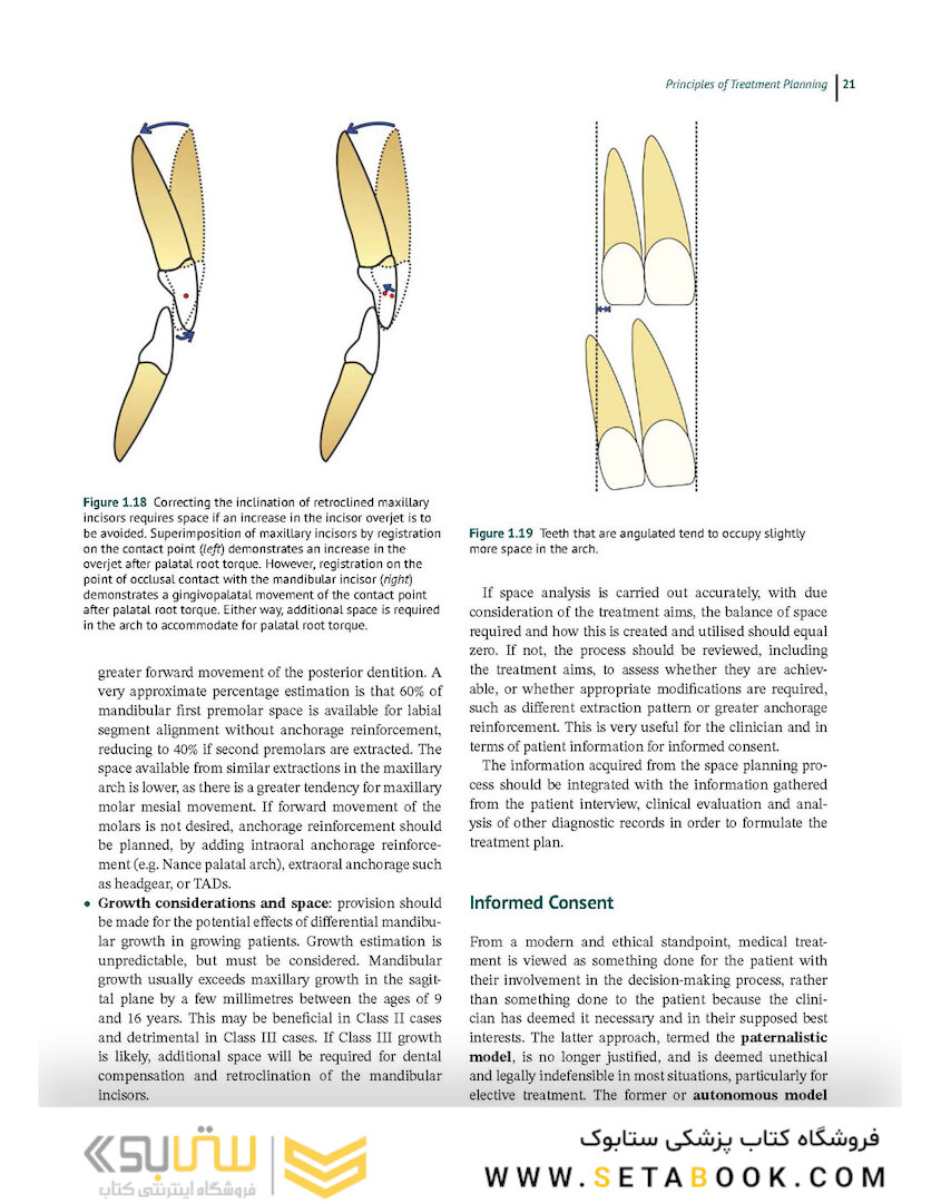 Preadjusted Edgewise Fixed Orthodontic Appliances: Principles and Practice 1st Edicion