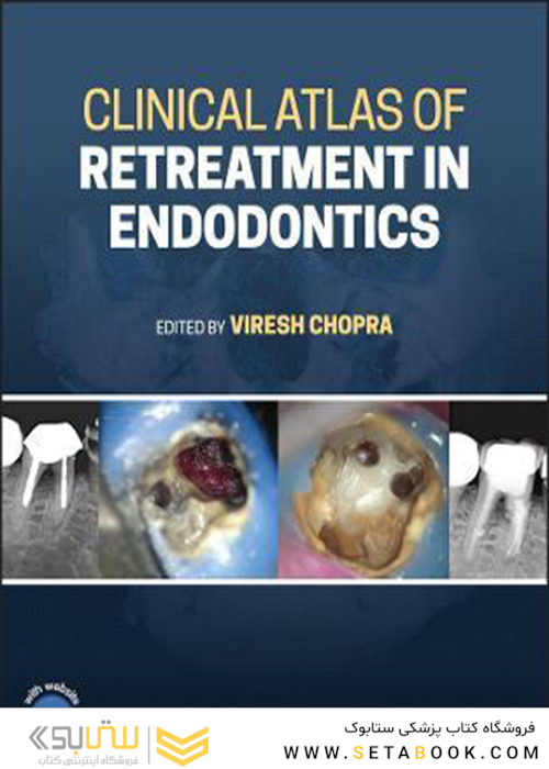 Clinical Atlas of Retreatment in Endodontics