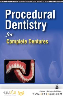 Procedural Dentistry for Complete Dentures