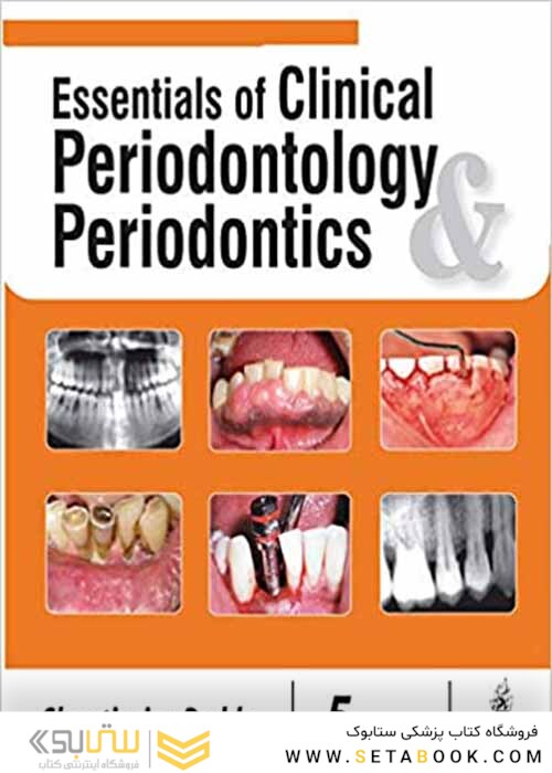 Essentials of Clinical Periodontology and Periodontics 5th Edición