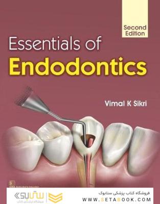 Essentials of Endodontics