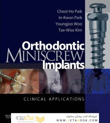 Orthodontic Miniscrew Implants : Clinical Applications
