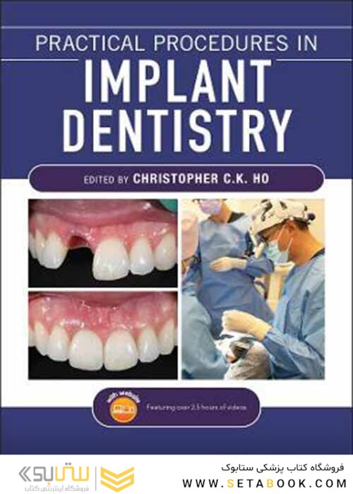 Practical Procedures in Implant Dentistry