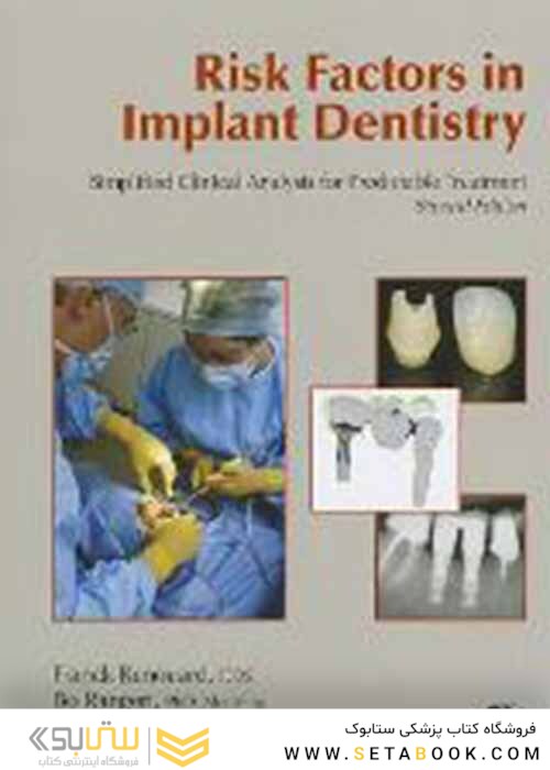 Risk Factors in Implant Dentistry