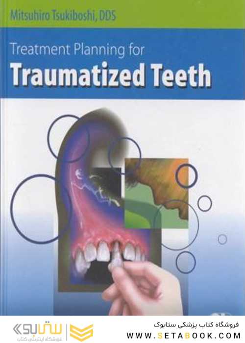 Treatment Planning for Traumatized Teeth