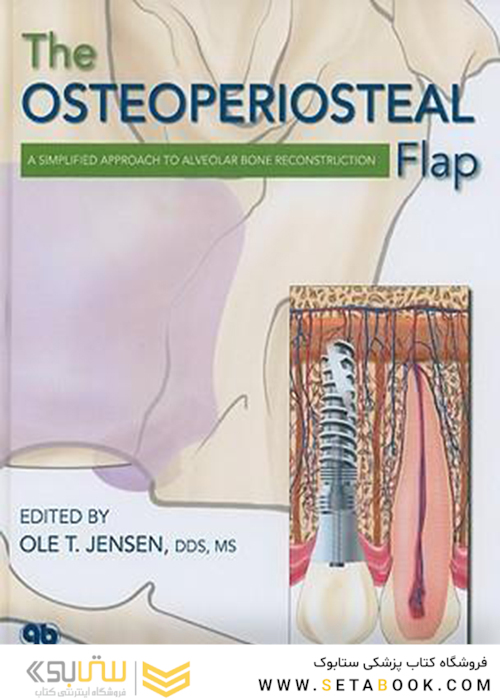 The Osteoperiosteal Flap : A Simplified Approach to Alveolar Bone Reconstruction