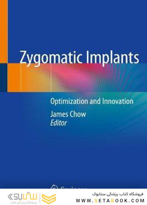 Zygomatic Implants : Optimization and Innovation