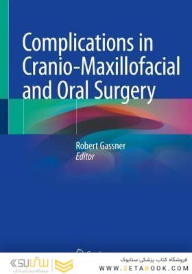 Complications in Cranio-Maxillofacial and Oral Surgery