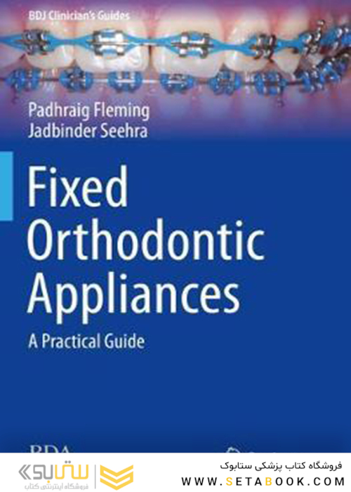 Fixed Orthodontic Appliances : A Practical Guide