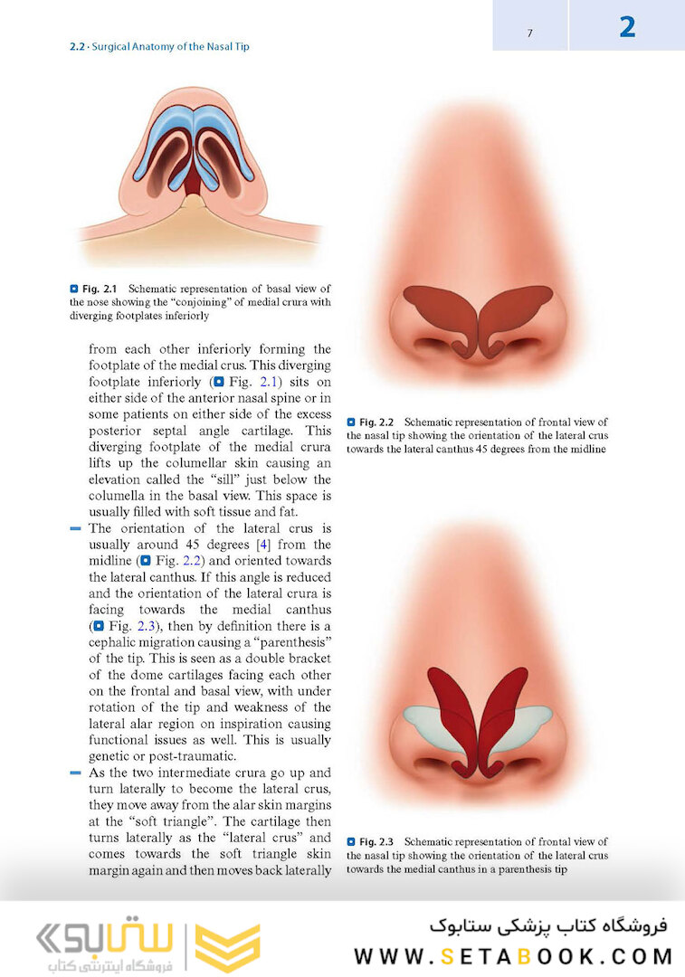 Textbook of Nasal Tip Rhinoplasty : Open Surgical Techniques