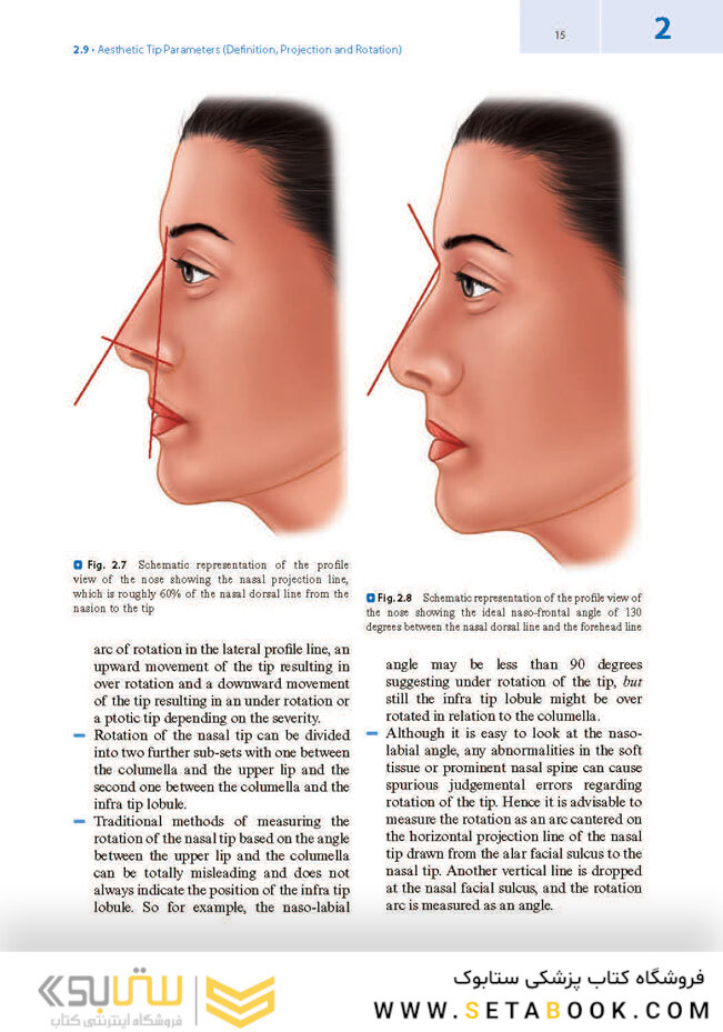Textbook of Nasal Tip Rhinoplasty : Open Surgical Techniques