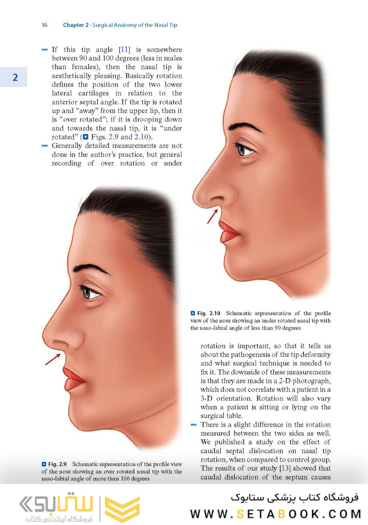 Textbook of Nasal Tip Rhinoplasty : Open Surgical Techniques