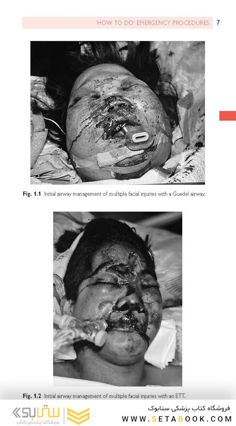 Oral and Maxillofacial Surgery (Oxford Specialist Handbooks in Surgery) 3rd Edicion 2020