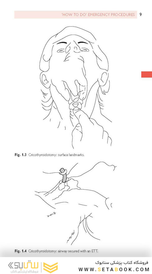 Oral and Maxillofacial Surgery (Oxford Specialist Handbooks in Surgery) 3rd Edicion 2020