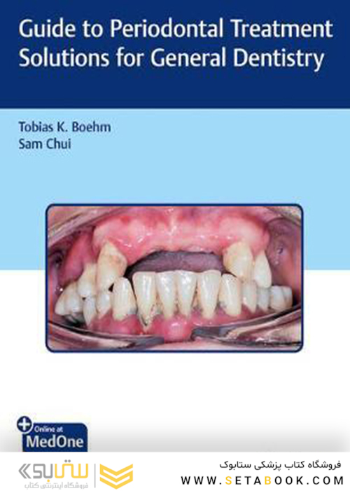 Guide to Periodontal Treatment Solutions for General Dentistry