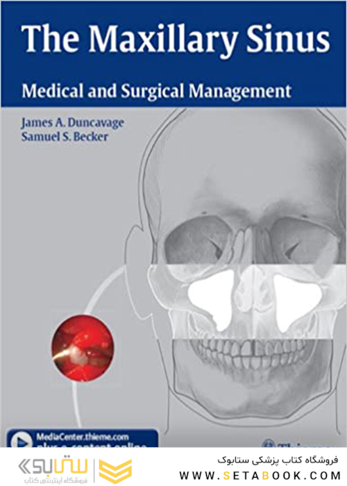 The Maxillary Sinus : Medical and Surgical Management