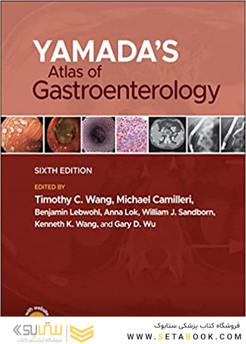 Yamada