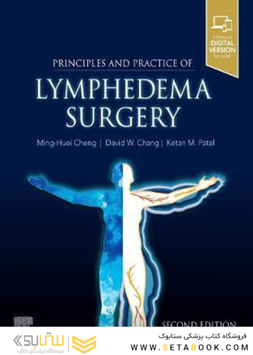 Principles and Practice of Lymphedema Surgery 2nd Edición