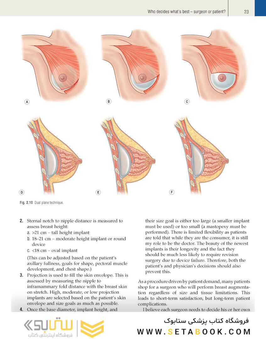 Plastic Surgery Volume 5: Breast 4th Edicion 2018