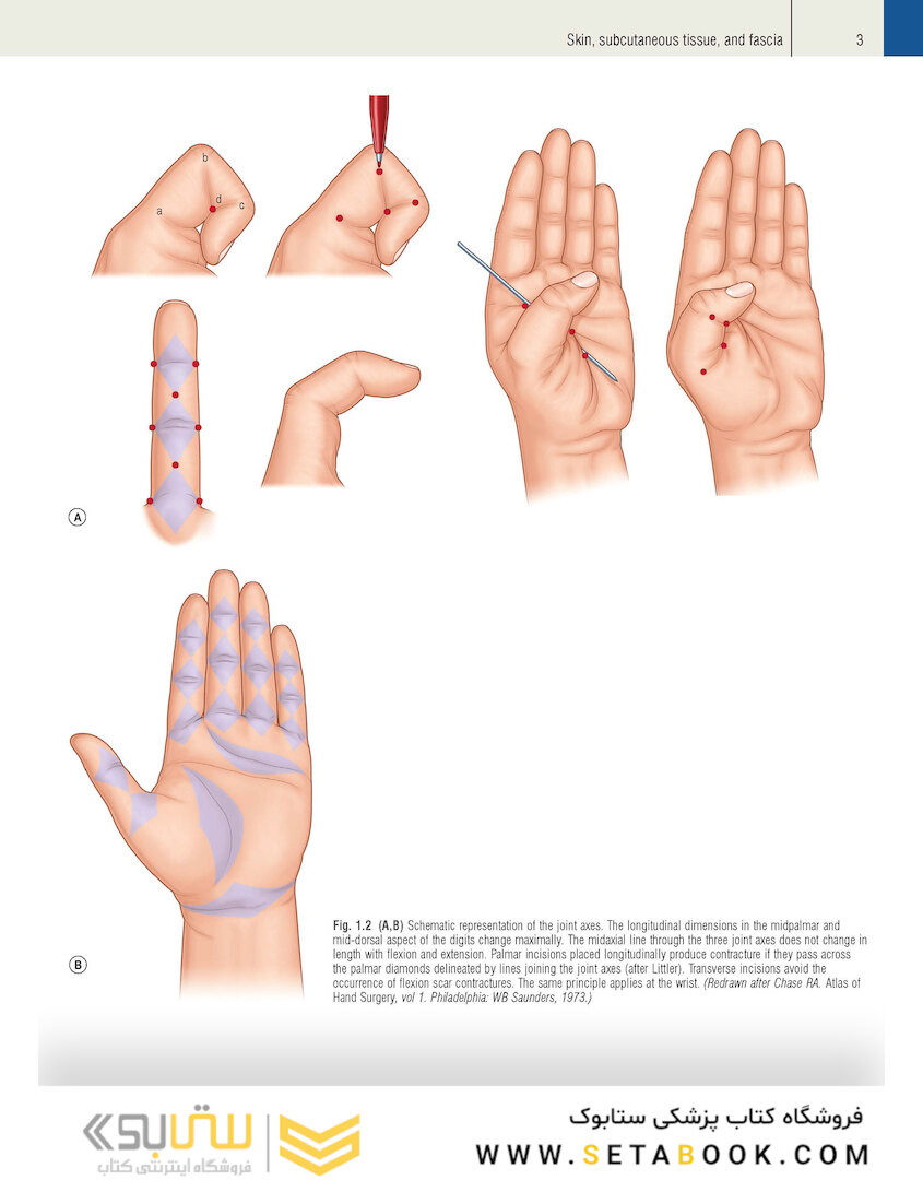 Plastic Surgery Volume 6: Hand and Upper Limb 4th Edicion 2018