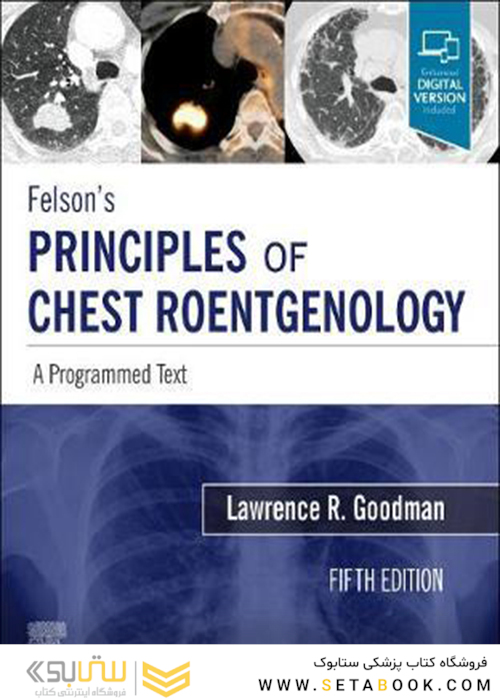 Felson’s PRINCIPLES OF CHEST ROENTGENOLOGY