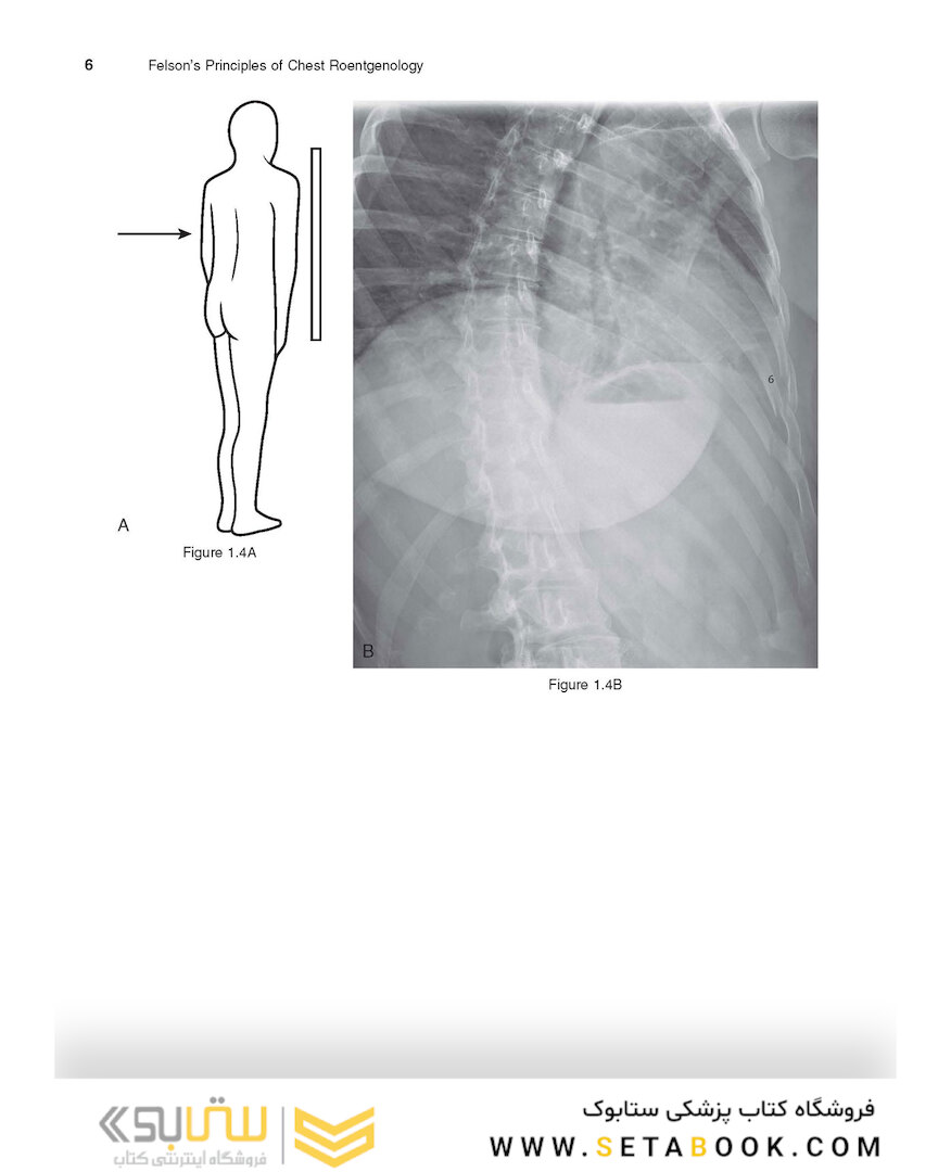 Felson’s PRINCIPLES OF CHEST ROENTGENOLOGY