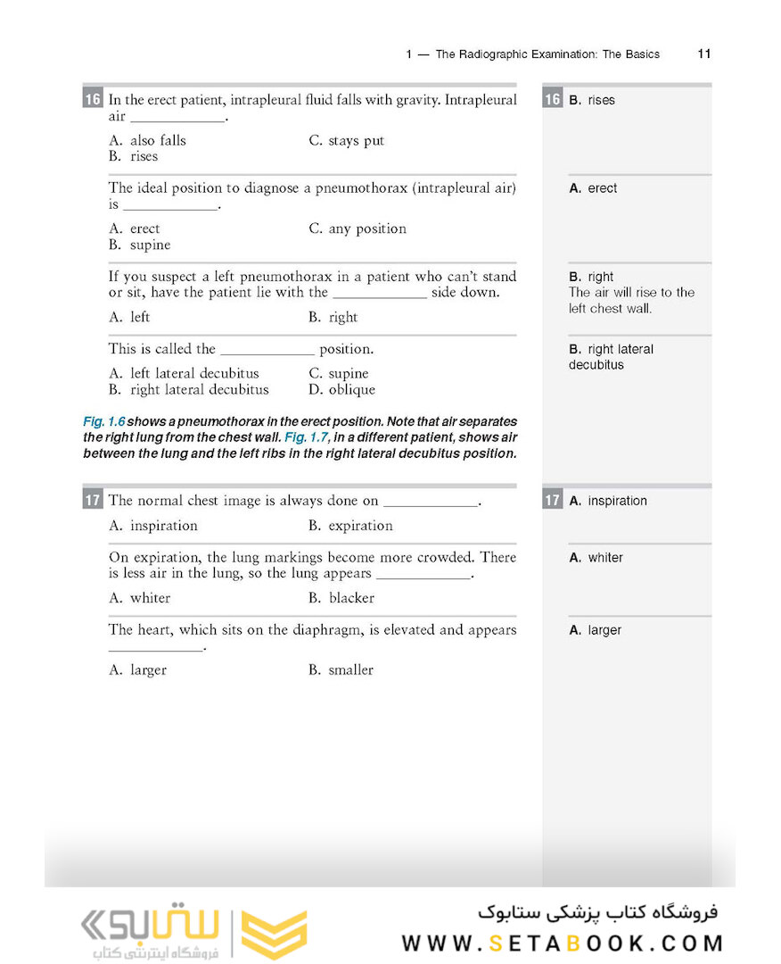 Felson’s PRINCIPLES OF CHEST ROENTGENOLOGY