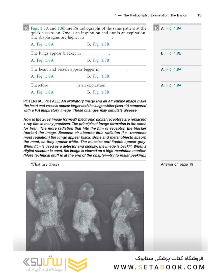 Felson’s PRINCIPLES OF CHEST ROENTGENOLOGY