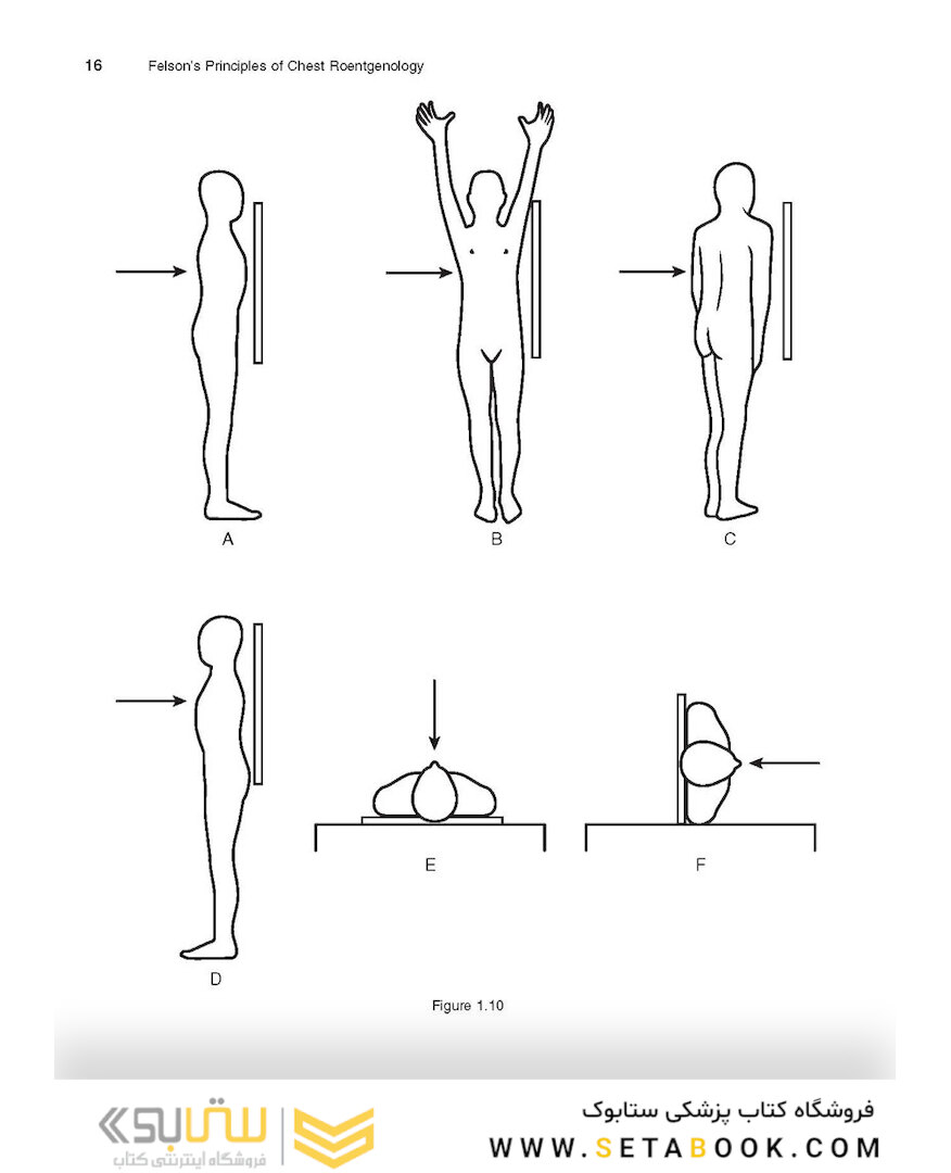 Felson’s PRINCIPLES OF CHEST ROENTGENOLOGY