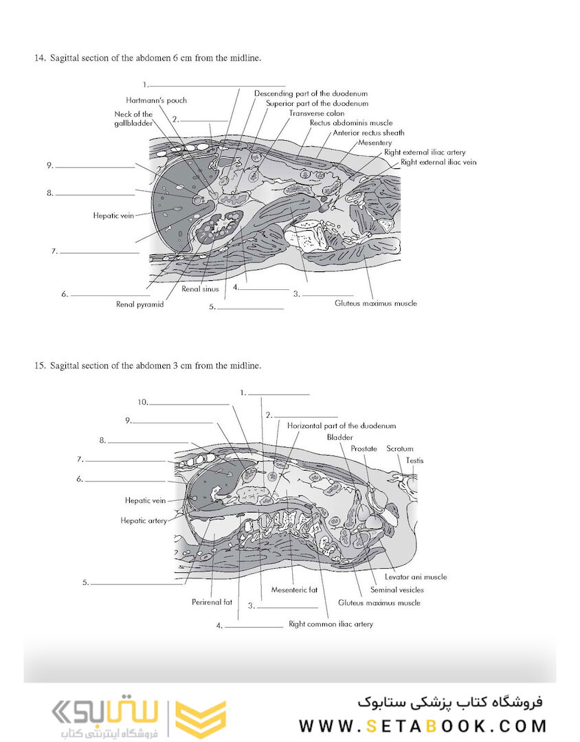Workbook for Textbook of Diagnostic Sonography 8th Edicion