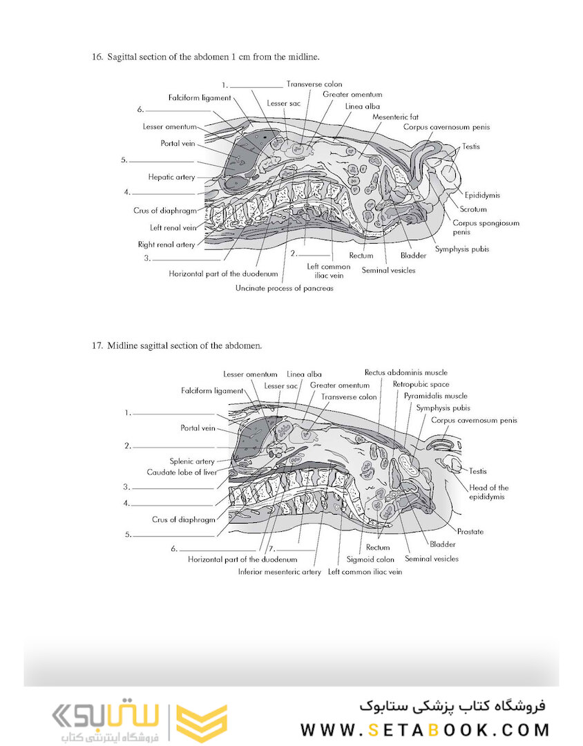Workbook for Textbook of Diagnostic Sonography 8th Edicion