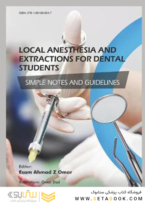 Local Anesthesia and Extractions for Dental Students : Simple Notes and Guidelines 2018