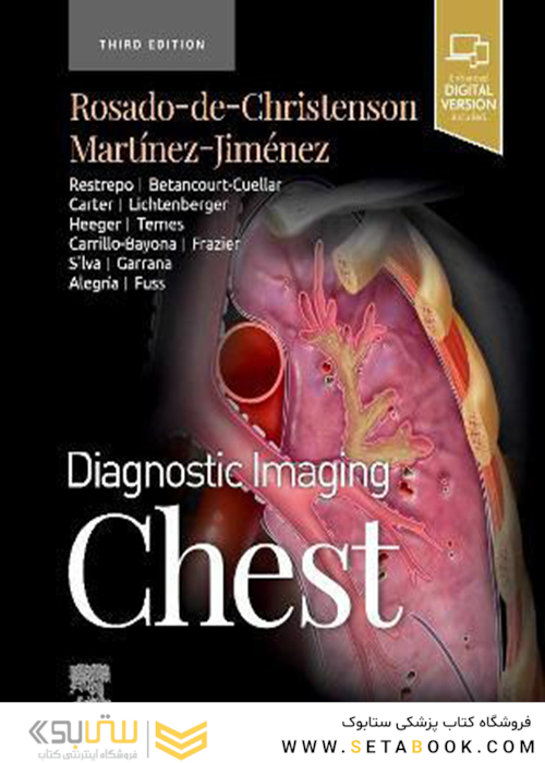 Diagnostic Imaging: Chest 3rd Edición