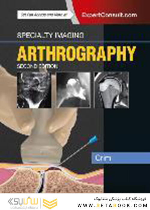 Specialty Imaging: Arthrography 2nd Edición