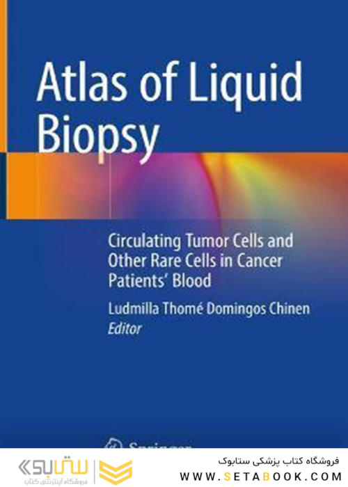 Atlas of Liquid Biopsy: Circulating Tumor Cells and Other Rare Cells in Cancer Patients’ Blood 1st ed. 2021 Edición