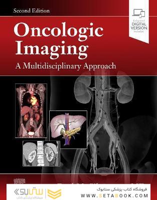 Oncologic Imaging: A Multidisciplinary Approach 2nd Edición