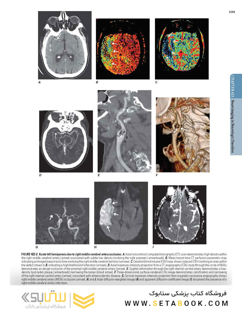 HARRISONS PRINCIPLES OF INTERNAL MEDICINE Part Neurologic Disorders