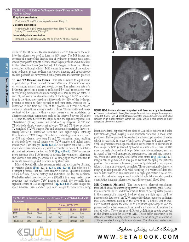 HARRISONS PRINCIPLES OF INTERNAL MEDICINE Part Neurologic Disorders