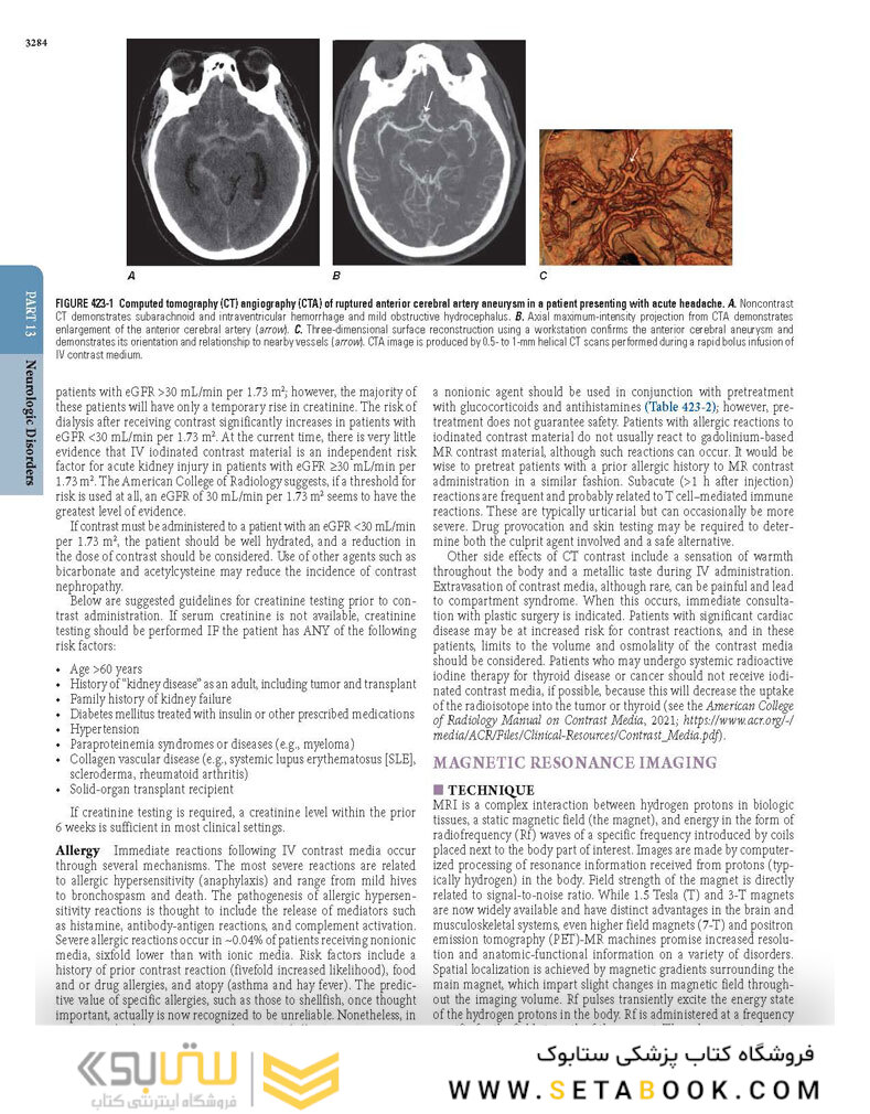 HARRISONS PRINCIPLES OF INTERNAL MEDICINE Part Neurologic Disorders