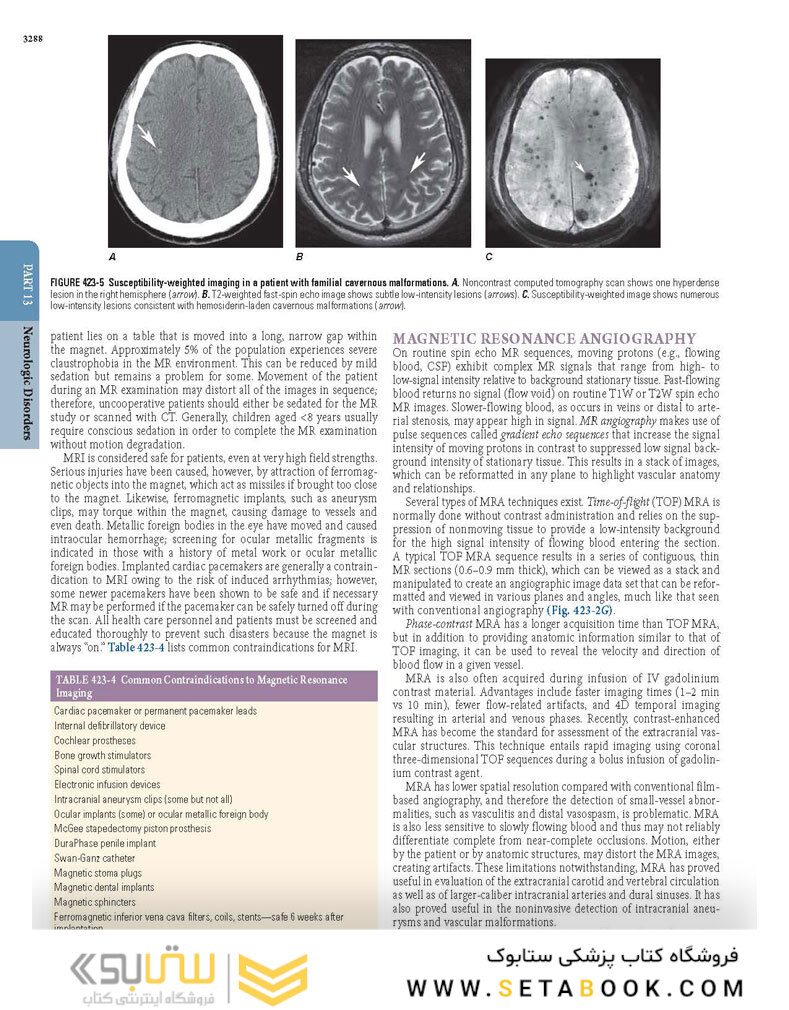 HARRISONS PRINCIPLES OF INTERNAL MEDICINE Part Neurologic Disorders