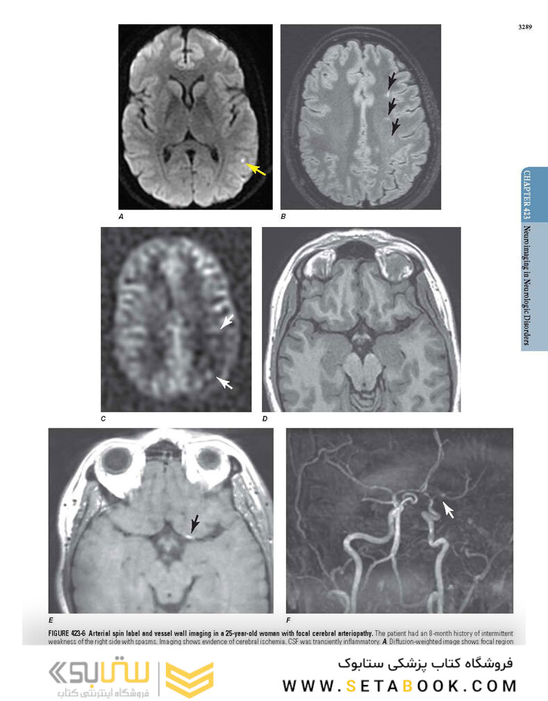 HARRISONS PRINCIPLES OF INTERNAL MEDICINE Part Neurologic Disorders