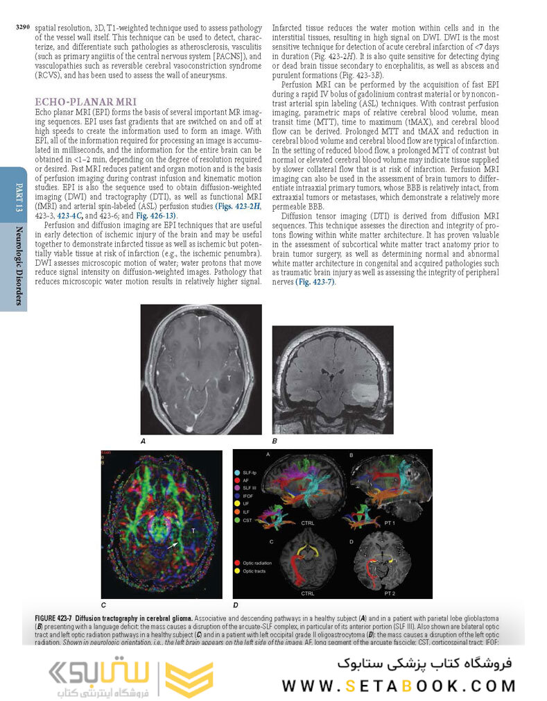 HARRISONS PRINCIPLES OF INTERNAL MEDICINE Part Neurologic Disorders