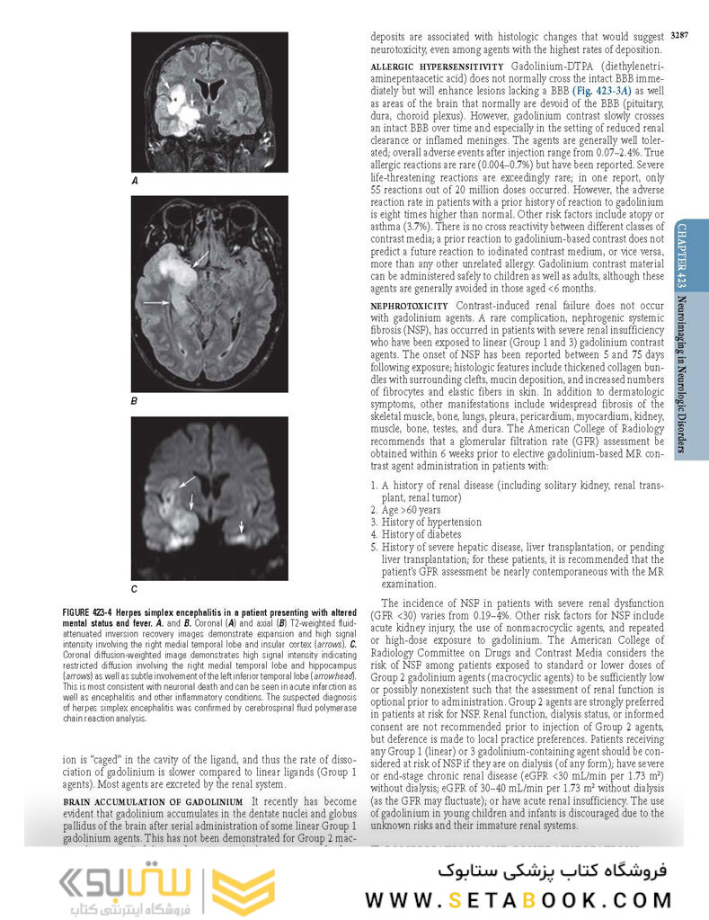 HARRISONS PRINCIPLES OF INTERNAL MEDICINE Part Neurologic Disorders