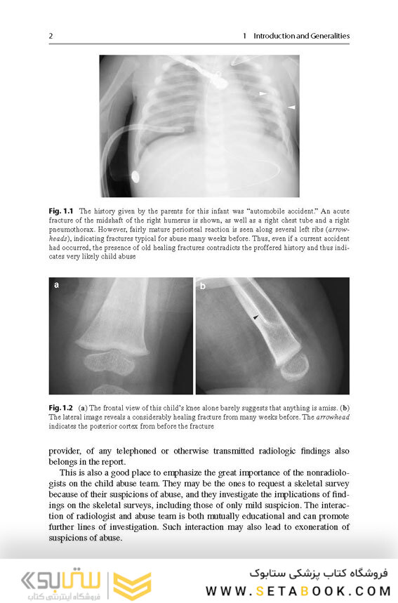 Recognizing Child Abuse in Radiology 1st ed. 2017 Edicion