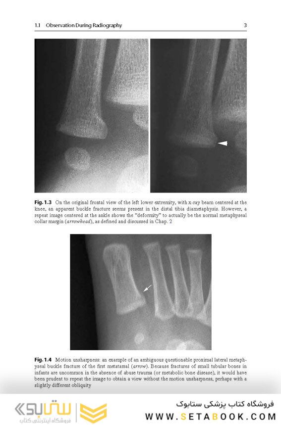 Recognizing Child Abuse in Radiology 1st ed. 2017 Edicion